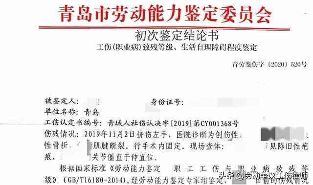 工伤后可以申请哪些赔偿金
